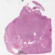 LMP27467-U Thumbnail