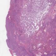 LMP38950-U Thumbnail