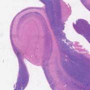 LMP57963-U Thumbnail