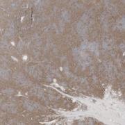 LMP65359-U Thumbnail