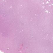 LMP37435-U Thumbnail
