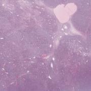 LMP34693-U Thumbnail