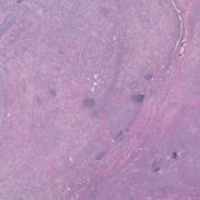 LMP38419-U Thumbnail
