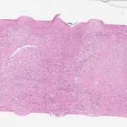 LMP62662-U Thumbnail