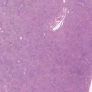 LMP68562-U Thumbnail