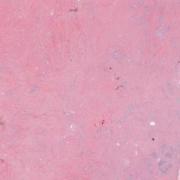 LMP57307-U Thumbnail