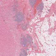 LMP55965-U Thumbnail