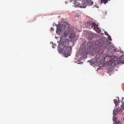 LMP31658-U Thumbnail