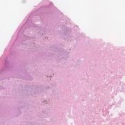 LMP56361-U Thumbnail