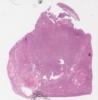 LMP27467-U Thumbnail