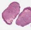 LMP43433-U Thumbnail