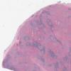 LMP34333-U Thumbnail