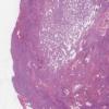 LMP38950-U Thumbnail