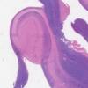 LMP57963-U Thumbnail