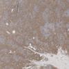 LMP65359-U Thumbnail