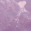LMP34693-U Thumbnail