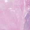 LMP54775-U Thumbnail