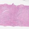 LMP62662-U Thumbnail
