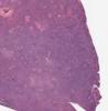 LMP57679-U Thumbnail