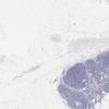 LMP44416-U Thumbnail
