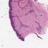 LMP34548-U Thumbnail