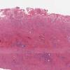LMP59485-U Thumbnail