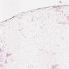 LMP81310-U Thumbnail