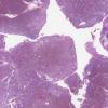 LMP39179-U Thumbnail