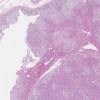 LMP80323-U Thumbnail