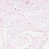 LMP58934-U Thumbnail