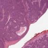 LMP33965-U Thumbnail