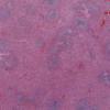 LMP37414-U Thumbnail