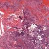 LMP33107-U Thumbnail